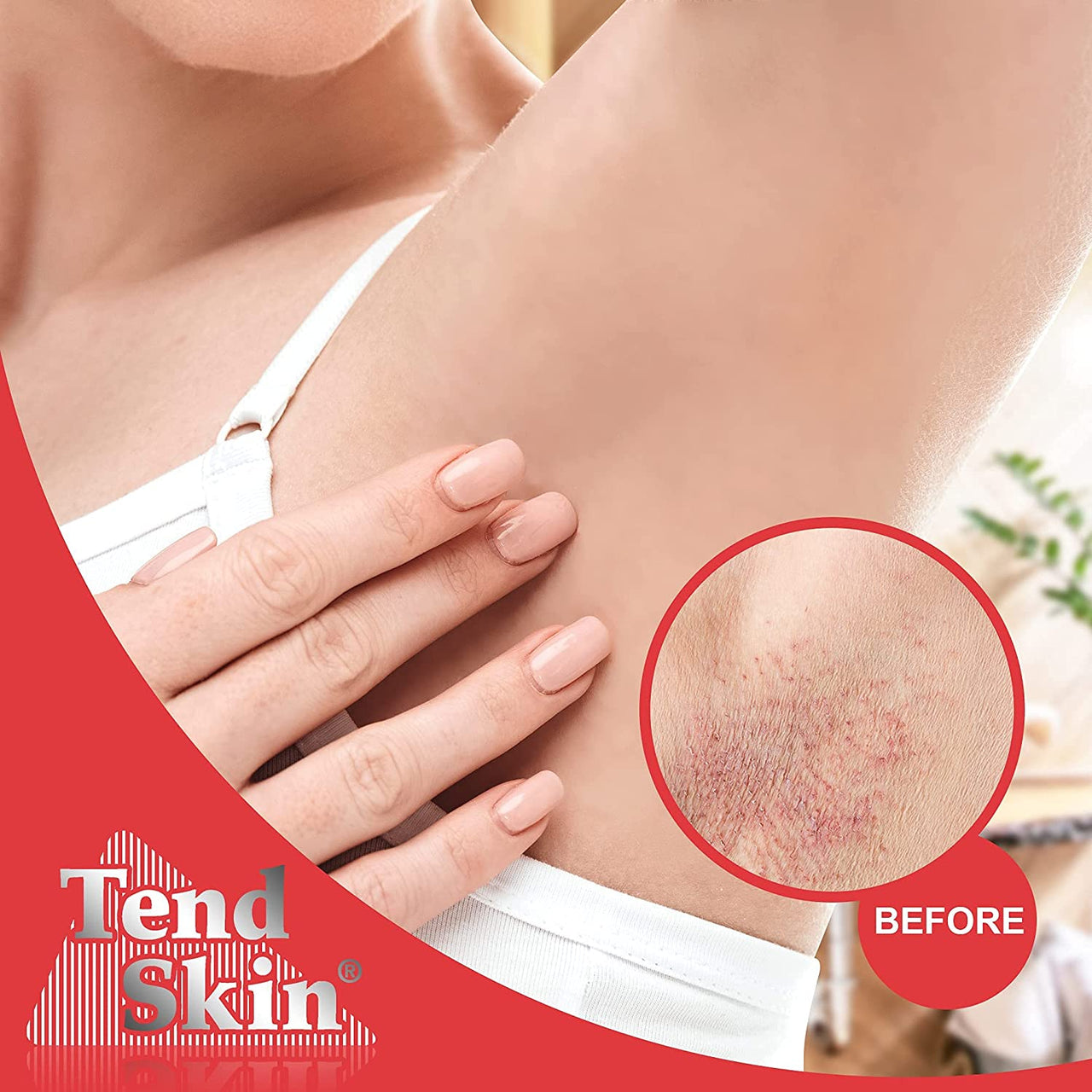 Tend Skin Razor Bumps Solution